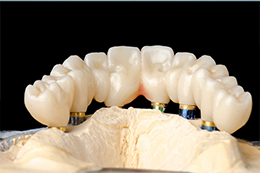 歯の審美用最新素材：ジルコニアについて