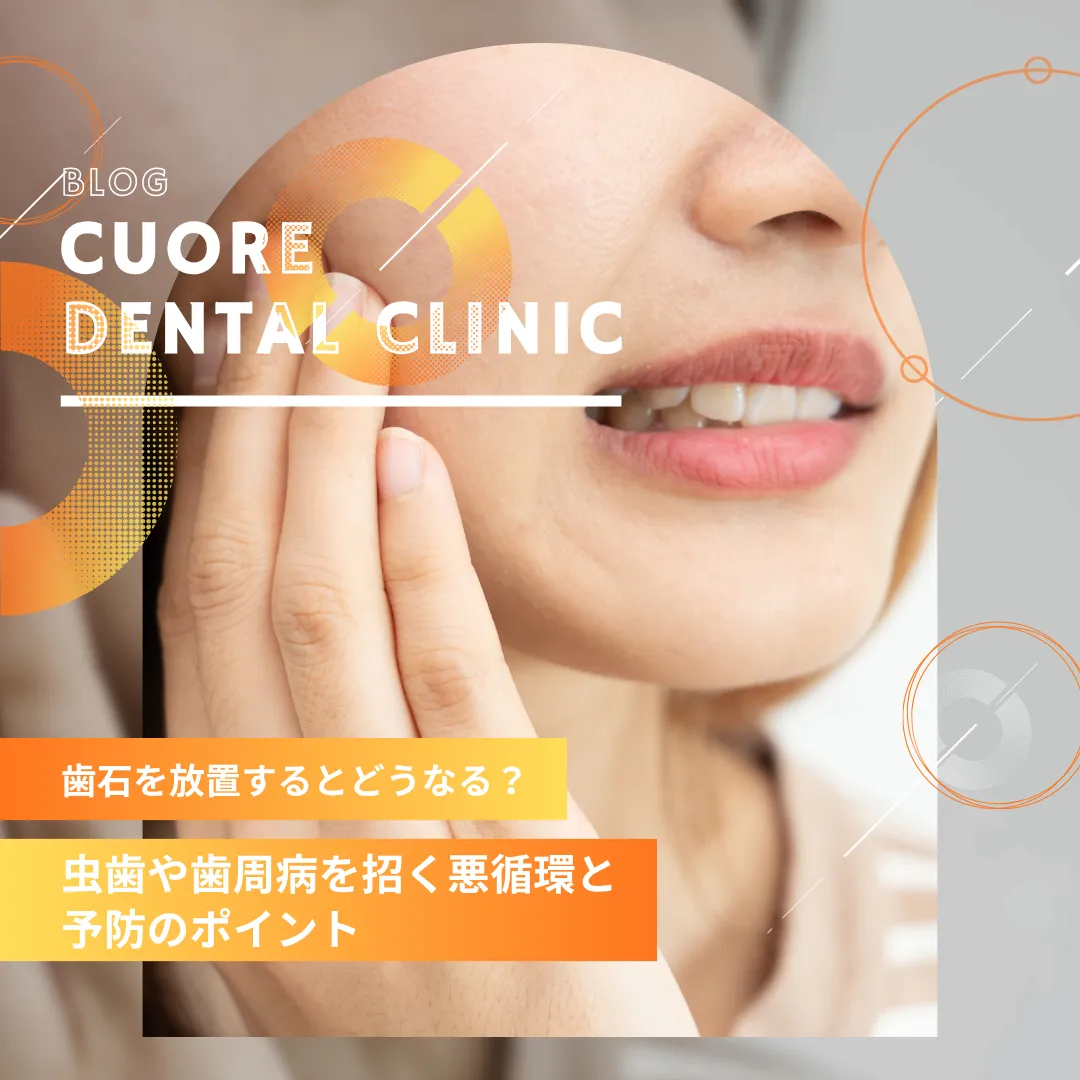 歯石を放置するとどうなる？虫歯や歯周病を招く悪循環と予防のポイント｜武蔵小金井駅徒歩2分の歯医者・歯科「クオーレ歯科クリニック」