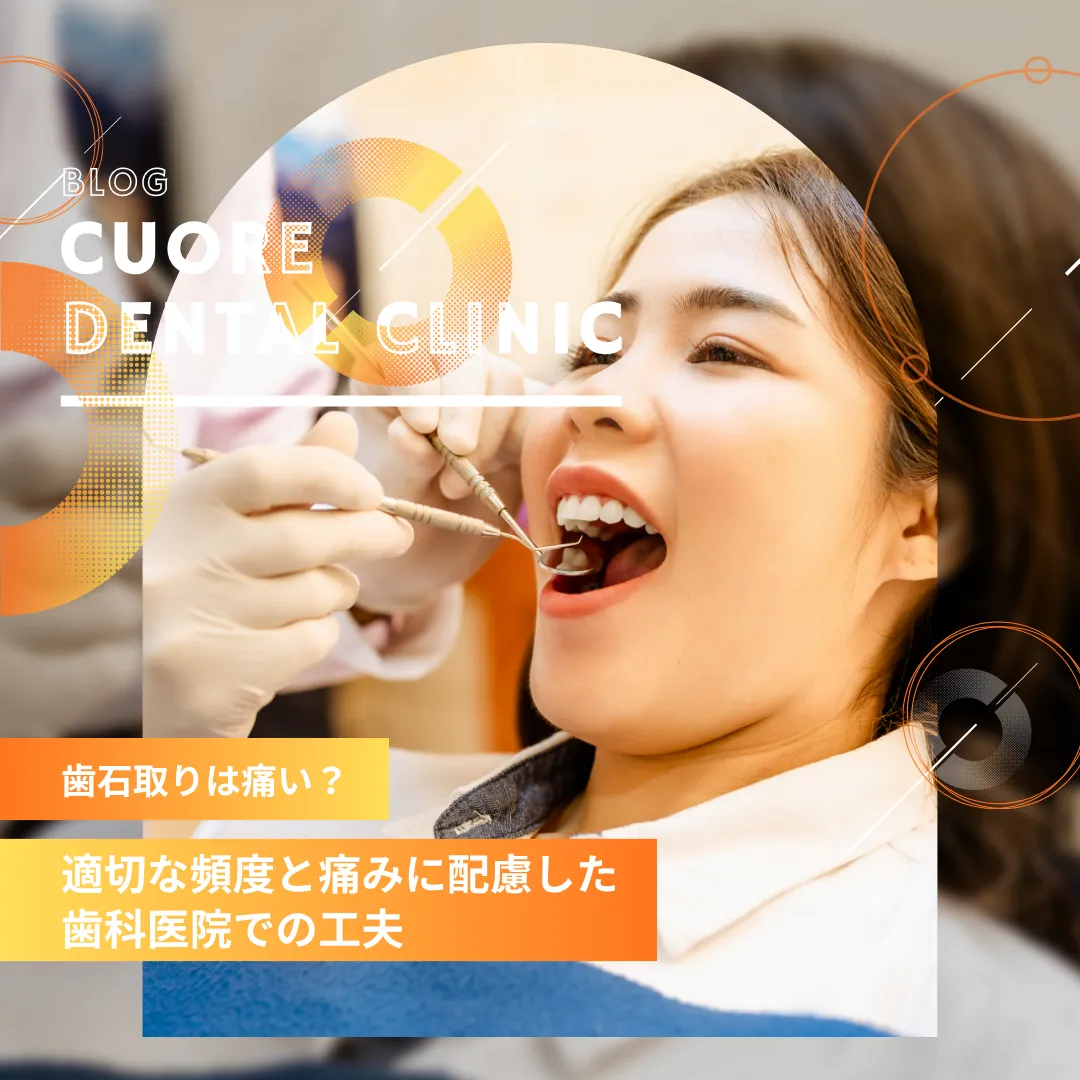 歯石取りは痛い？適切な頻度と痛みに配慮した歯科医院での工夫｜武蔵小金井駅徒歩2分の歯医者・歯科「クオーレ歯科クリニック」