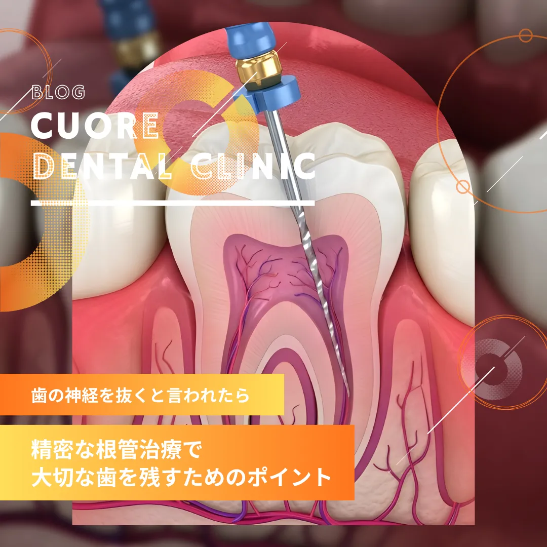 歯の神経を抜くと言われたら｜精密な根管治療で大切な歯を残すためのポイント｜武蔵小金井駅徒歩2分の歯医者・歯科「クオーレ歯科クリニック」