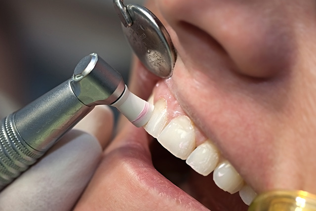 PMTC｜武蔵小金井駅徒歩2分の歯医者・歯科「クオーレ歯科クリニック」