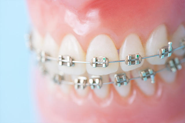 矯正｜武蔵小金井駅徒歩2分の歯医者・歯科「クオーレ歯科クリニック」