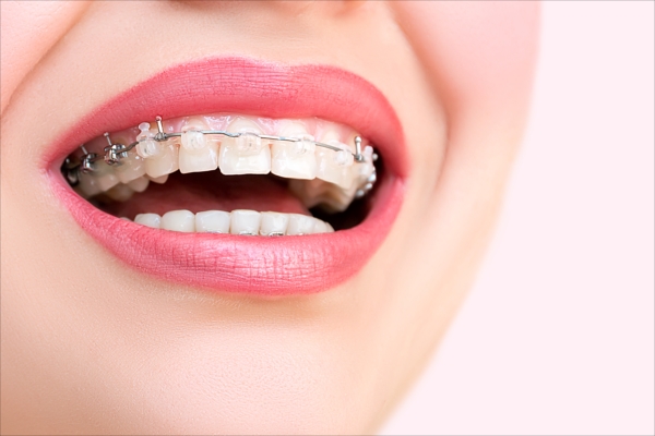 なぜ矯正歯科治療が大切なのか